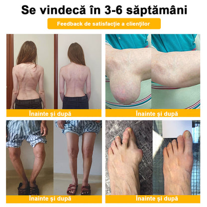 ArthroFree™ Venin de albine Cremă Terapeutică Analgezică🐝(în mod special pentru adulți mai în vârstă & SRCT recomandă)