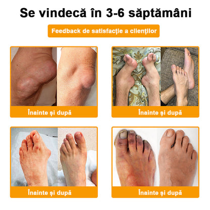 ArthroFree™ Venin de albine Cremă Terapeutică Analgezică🐝(în mod special pentru adulți mai în vârstă & SRCT recomandă)